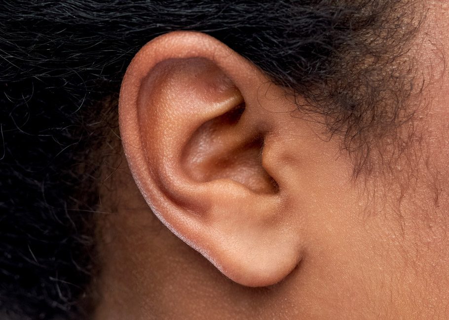 Ear Lobule Repair